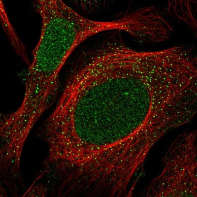Immunocytochemistry/Immunofluorescence: CCDC92 Antibody [NBP1-82119] - Staining of human cell line U-2 OS shows positivity in nucleus and vesicles.