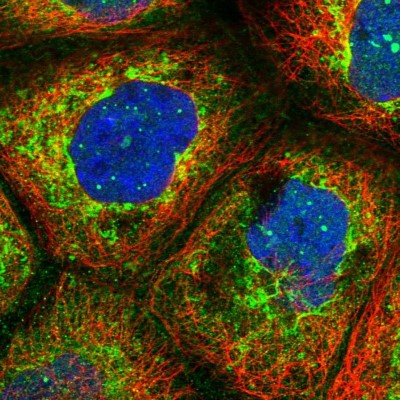 Immunocytochemistry/Immunofluorescence: LYSMD2 Antibody [NBP1-82702] - Immunofluorescent staining of human cell line A-431 shows localization to nuclear bodies & mitochondria.