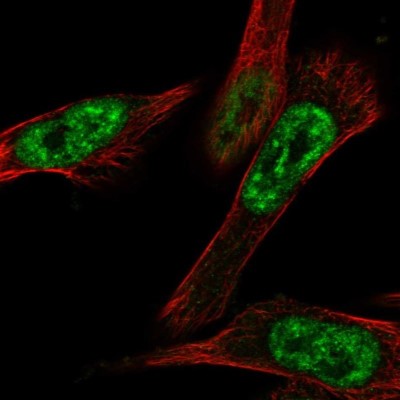 Immunocytochemistry/Immunofluorescence: CBLL1 Antibody [NBP1-83588] - Staining of human cell line U-251 MG shows localization to nuclear speckles.