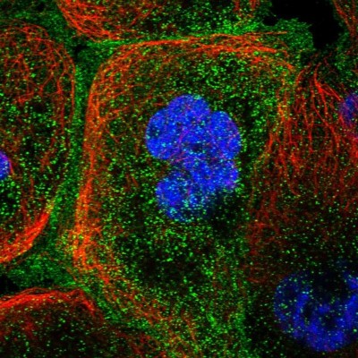 Immunocytochemistry/Immunofluorescence: TMC5 Antibody [NBP1-83697] - Staining of human cell line A-431 shows positivity in plasma membrane.
