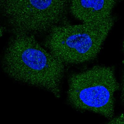 Immunocytochemistry/Immunofluorescence: TRIM47 Antibody [NBP1-83353] - Immunofluorescent staining of human cell line A549 shows localization to cytosol.