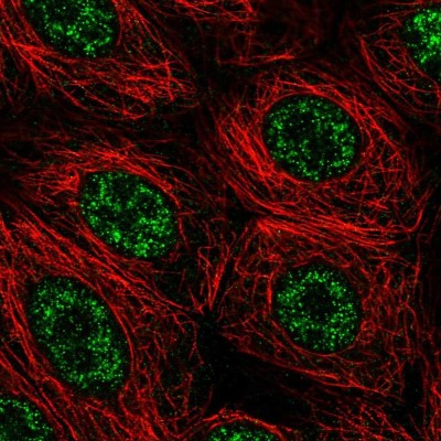 Immunocytochemistry/Immunofluorescence: FIBP Antibody [NBP1-83903] - Immunofluorescent staining of human cell line MCF7 shows localization to nuclear speckles.