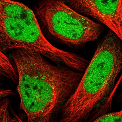 Immunocytochemistry/Immunofluorescence: ZNF326 Antibody [NBP1-83658] - Immunofluorescent staining of human cell line U-2 OS shows localization to nucleoplasm & the Golgi apparatus.