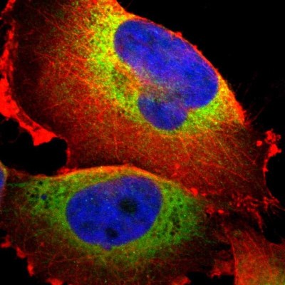 Immunocytochemistry/Immunofluorescence: P4HA1 Antibody [NBP1-84397] - Immunofluorescent staining of human cell line U-251 MG shows localization to endoplasmic reticulum.