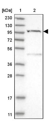 Western Blot: C1orf112 Antibody [NBP1-83836] - Lane 1: Marker  [kDa] 230, 130, 95, 72, 56, 36, 28, 17, 11.  Lane 2: Human cell line RT-74