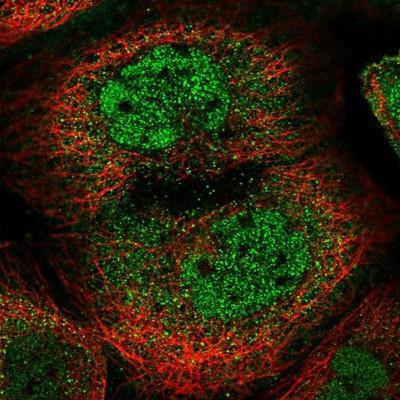 Immunocytochemistry/Immunofluorescence: HOXB1 Antibody [NBP1-83231] - Staining of human cell line A-431 shows positivity in nucleus but not nucleoli and cytoplasm.