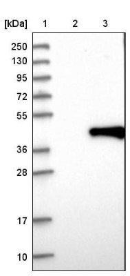 Western Blot: Torsin 1B Antibody [NBP1-84983] - Lane 1: Marker [kDa] 250, 130, 95, 72, 55, 36, 28, 17, 10. Lane 2: Negative control (vector only transfected HEK293T lysate). Lane 3: Over-expression lysate (Co-expressed with a C-terminal myc-DDK tag (3.1 kDa) in mammalian HEK293T cells).