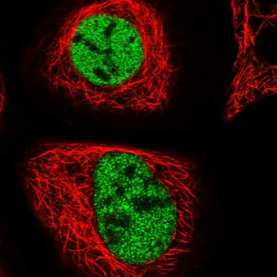 Immunocytochemistry/Immunofluorescence: ZMIZ2 Antibody [NBP1-85032] - Immunofluorescent staining of human cell line A-431 shows localization to nucleoplasm.