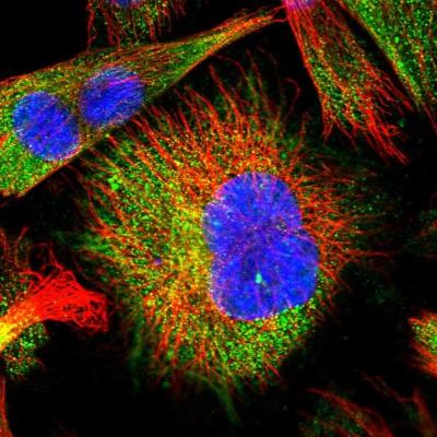 Immunocytochemistry/Immunofluorescence: PLAC9 Antibody [NBP1-86202] - Staining of human cell line U-251 MG shows positivity in cytoplasm and cytoskeleton (intermediate filaments).