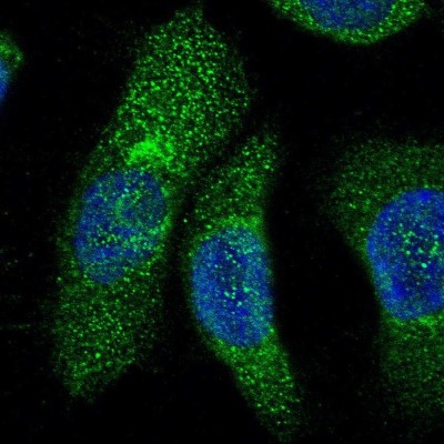 Immunocytochemistry/Immunofluorescence: FMO5 Antibody [NBP1-86093] - Immunofluorescent staining of human cell line A-431 shows localization to endoplasmic reticulum.