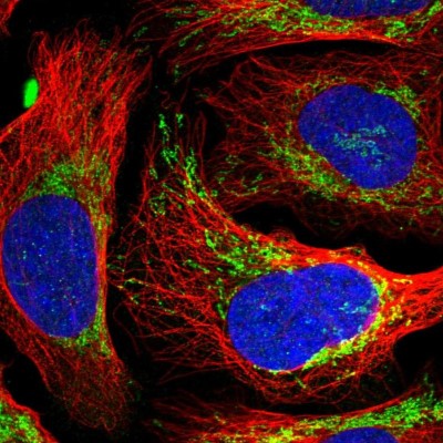 Immunocytochemistry/Immunofluorescence: EVC2 Antibody [NBP2-47467] - Immunofluorescent staining of human cell line U-2 OS shows localization to mitochondria.