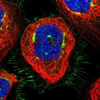 Immunocytochemistry/Immunofluorescence: GCC1 Antibody [NBP1-83610] - Immunofluorescent staining of human cell line A-431 shows localization to plasma membrane, cytosol & the Golgi apparatus.