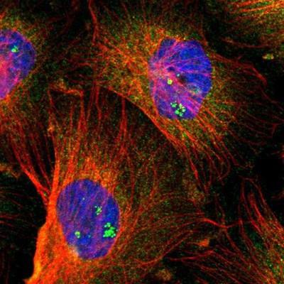 Immunocytochemistry/Immunofluorescence: CC2D1A Antibody [NBP1-83666] - Staining of human cell line U-251MG shows positivity in nucleoli and cytoplasm.