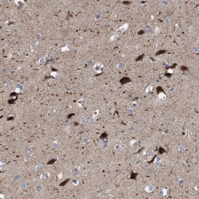 Immunohistochemistry-Paraffin: C7orf64 Antibody [NBP1-84150] - Staining of human cerebral cortex shows cytoplasmic positivity in neuronal cells.
