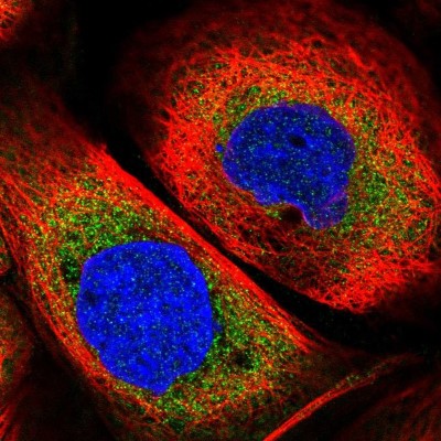 Immunocytochemistry/Immunofluorescence: eIF4GII Antibody [NBP1-84867] - Immunofluorescent staining of human cell line A-431 shows localization to cytosol.
