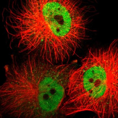 Immunocytochemistry/Immunofluorescence: ZNF540 Antibody [NBP1-84170] - Immunofluorescent staining of human cell line U-251 MG shows localization to nucleoplasm & vesicles.
