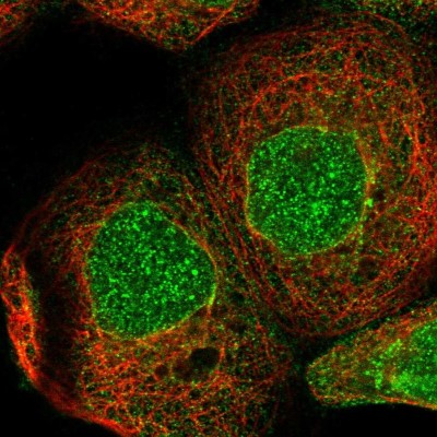Immunocytochemistry/Immunofluorescence: ZBTB41 Antibody [NBP1-84119] - Immunofluorescent staining of human cell line A-431 shows localization to nucleus, nuclear membrane & cytosol.
