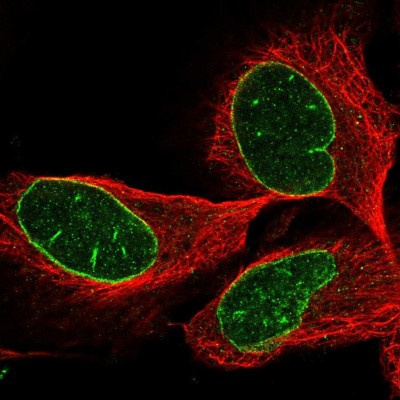 Immunocytochemistry/Immunofluorescence: Connexin 40.1 Antibody [NBP1-85374] - Staining of human cell line U-2 OS shows positivity in nuclear membrane.