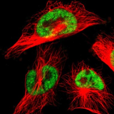 Immunocytochemistry/Immunofluorescence: THRAP3 Antibody [NBP1-86915] - Immunofluorescent staining of human cell line U-251 MG shows localization to nuclear speckles.