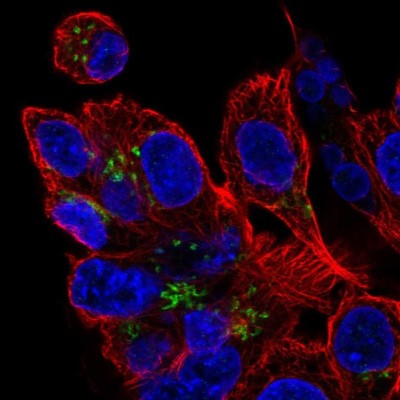 Immunocytochemistry/Immunofluorescence: ZDHHC7 Antibody [NBP2-32486] - Immunofluorescent staining of human cell line Hep G2 shows localization to the Golgi apparatus.