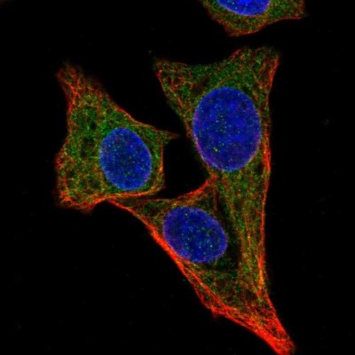 Immunocytochemistry/Immunofluorescence: ALG1 Antibody [NBP2-32539] - Staining of human cell line Hep G2 shows localization to nucleoli fibrillar center & endoplasmic reticulum.