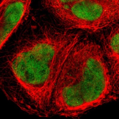 Immunocytochemistry/Immunofluorescence: FOXJ2 Antibody [NBP1-83897] - Immunofluorescent staining of human cell line A-431 shows localization to nucleus & nucleoli fibrillar center.
