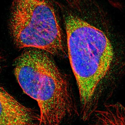 Immunocytochemistry/Immunofluorescence: RAD54B Antibody [NBP1-83417] - Staining of human cell line U-2 OS shows positivity in cytoplasm.