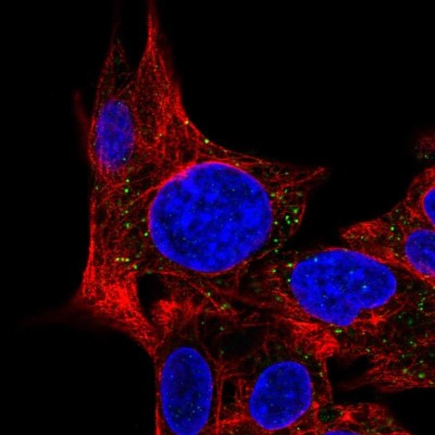 Immunocytochemistry/Immunofluorescence: MPV17L Antibody [NBP1-83466] - Immunofluorescent staining of human cell line Hep G2 shows localization to vesicles.