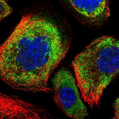 Immunocytochemistry/Immunofluorescence: OTUD5 Antibody [NBP1-85044] - Staining of human cell line A-431 shows localization to cytosol.