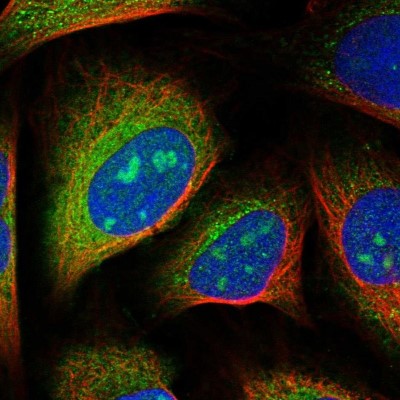 Immunocytochemistry/Immunofluorescence: FAM102B Antibody [NBP1-84085] - Immunofluorescent staining of human cell line U-2 OS shows localization to nucleoli & cytosol.