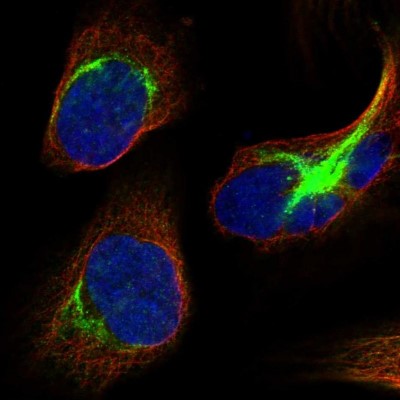 Immunocytochemistry/Immunofluorescence: DHX57 Antibody [NBP1-85267] - Immunofluorescent staining of human cell line U-2 OS shows localization to intermediate filaments.