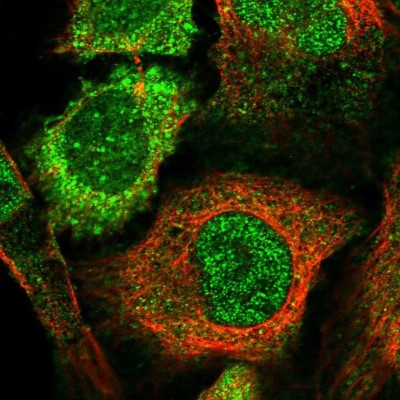 Immunocytochemistry/Immunofluorescence: SOCS-5 Antibody [NBP1-85608] - Staining of human cell line U-2 OS shows localization to nucleoplasm & cytosol.
