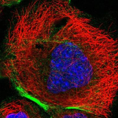Immunocytochemistry/Immunofluorescence: FSD1L Antibody [NBP1-86583] - Staining  of human cell line A-431 shows positivity in plasma membrane and cytoskeleton (actin filaments).