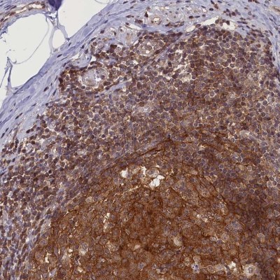Immunocytochemistry/Immunofluorescence: FCHO1 Antibody [NBP1-81523] - Staining of human appendix shows strong cytoplasmic positivity in lymphoid tissue.