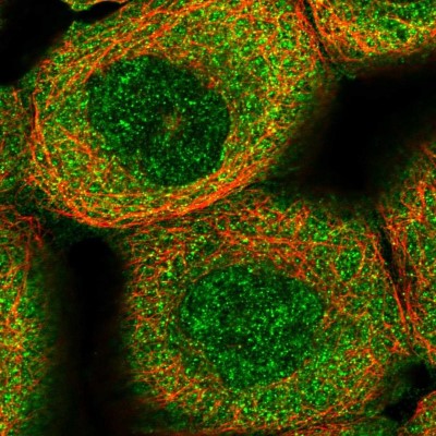 Immunocytochemistry/Immunofluorescence: RPP14 Antibody [NBP1-80965] - Immunofluorescent staining of human cell line A-431 shows localization to nucleoplasm & cytosol.
