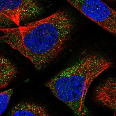 Immunocytochemistry/Immunofluorescence: CNOT6 Antibody [NBP1-86564] - Immunofluorescent staining of human cell line U-2 OS shows localization to cytosol.