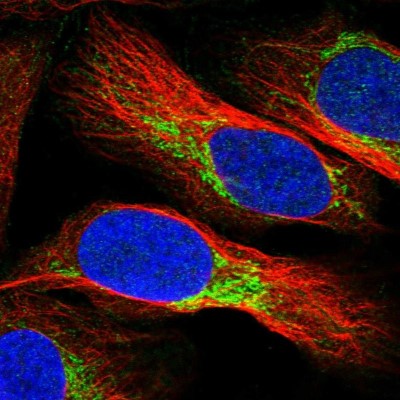 Immunocytochemistry/Immunofluorescence: NDUFV3 Antibody [NBP1-85621] - Immunofluorescent staining of human cell line U-2 OS shows localization to mitochondria.