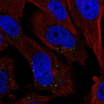 Immunocytochemistry/Immunofluorescence: GBP4 Antibody [NBP1-82628] - Staining of human cell line U-251MG shows positivity in vesicles.
