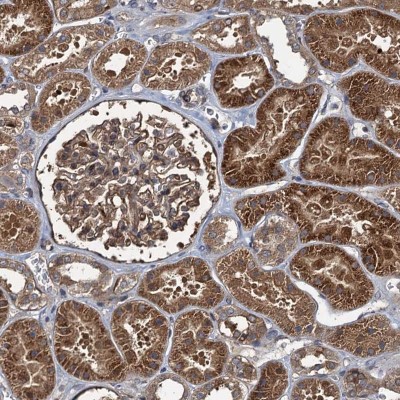 Immunocytochemistry/Immunofluorescence: RHOBTB1 Antibody [NBP1-81485] - Staining of human kidney shows strong cytoplasmic positivity in cells in tubules and in glomeruli