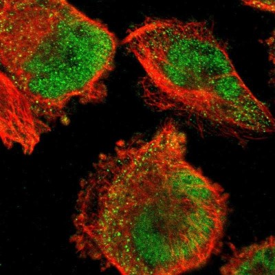 Immunocytochemistry/Immunofluorescence: FBXO8 Antibody [NBP1-84716] - Staining of human cell line U-251 MG shows localization to nucleoplasm & cytosol.