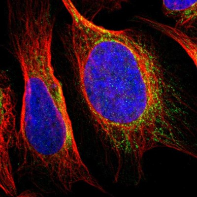 Immunocytochemistry/Immunofluorescence: SNX19 Antibody [NBP1-84491] - Immunofluorescent staining of human cell line U-2 OS shows localization to mitochondria.