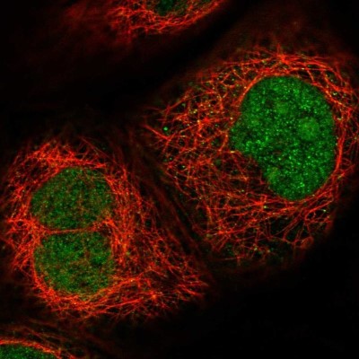Immunocytochemistry/Immunofluorescence: MPHOSPH6 Antibody [NBP1-82626] - Staining of human cell line A-431 shows localization to nucleus & nucleoli.