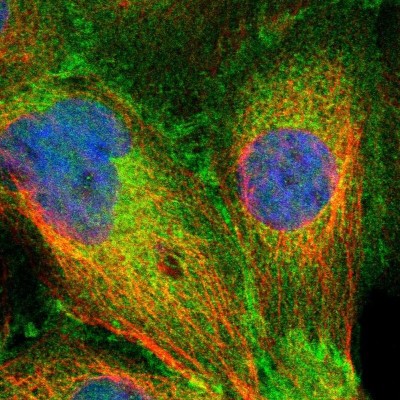 Immunocytochemistry/Immunofluorescence: SLK Antibody [NBP1-83024] - Immunofluorescent staining of human cell line A-431 shows localization to plasma membrane & cytosol.