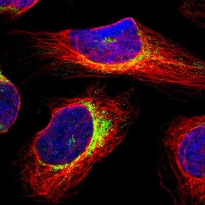 Immunocytochemistry/Immunofluorescence: DDX26B Antibody [NBP1-81910] - Staining of human cell line U-2 OS shows positivity in mitochondria.