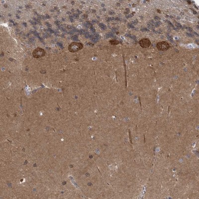 Immunocytochemistry/Immunofluorescence: TRIM2 Antibody [NBP1-81504] - Staining of human cerebellum shows strong cytoplasmic positivity in Purkinje cells.