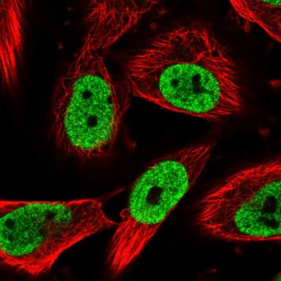 Immunocytochemistry/Immunofluorescence: NUP88 Antibody [NBP1-82658] - Immunofluorescent staining of human cell line U-251 MG shows localization to nucleoplasm.