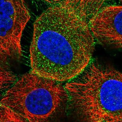 Immunocytochemistry/Immunofluorescence: SRD5A3 Antibody [NBP1-82259] - Staining of human cell line A-431 shows positivity in plasma membrane and cytoplasm.