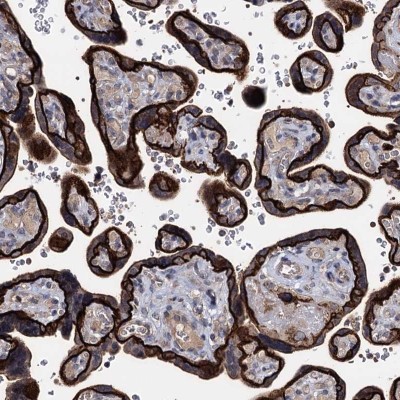 Immunocytochemistry/Immunofluorescence: SMAGP Antibody [NBP1-81686] - Staining of human placenta shows cytoplasmic and membranous positivity in trophoblastic cells.
