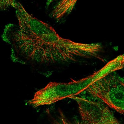Immunocytochemistry/Immunofluorescence: SMAGP Antibody [NBP1-81686] - Immunofluorescent staining of human cell line U-251 MG shows localization to nucleoplasm & plasma membrane.