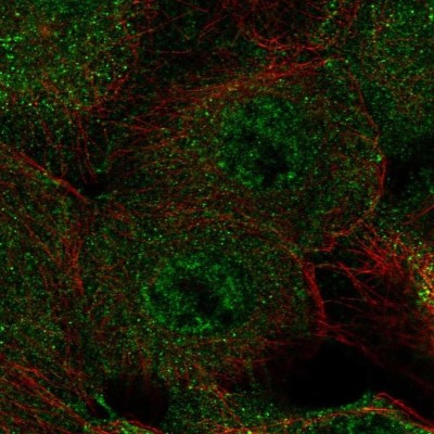 Immunocytochemistry/Immunofluorescence: CNG1 Antibody [NBP2-56003] - Staining of human cell line A-431 shows localization to plasma membrane & vesicles.